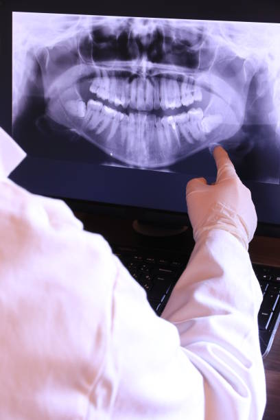 Best Emergency Dental Extractions in Central High, OK